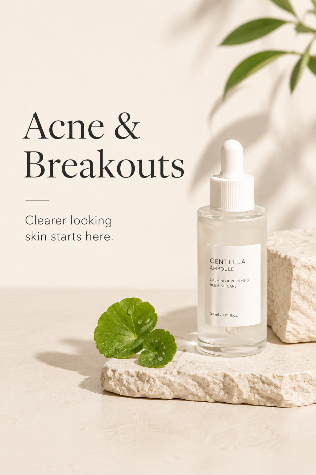 Acne & Breakouts